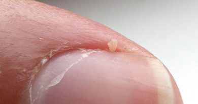 nails peeling and splitting - BleepingWorld