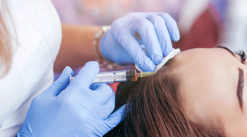 What is the Best Non-Surgical Treatment for Hair Loss?