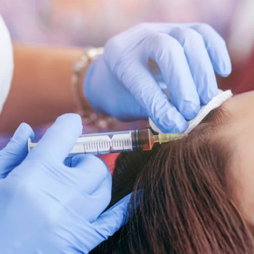 What is the Best Non-Surgical Treatment for Hair Loss?
